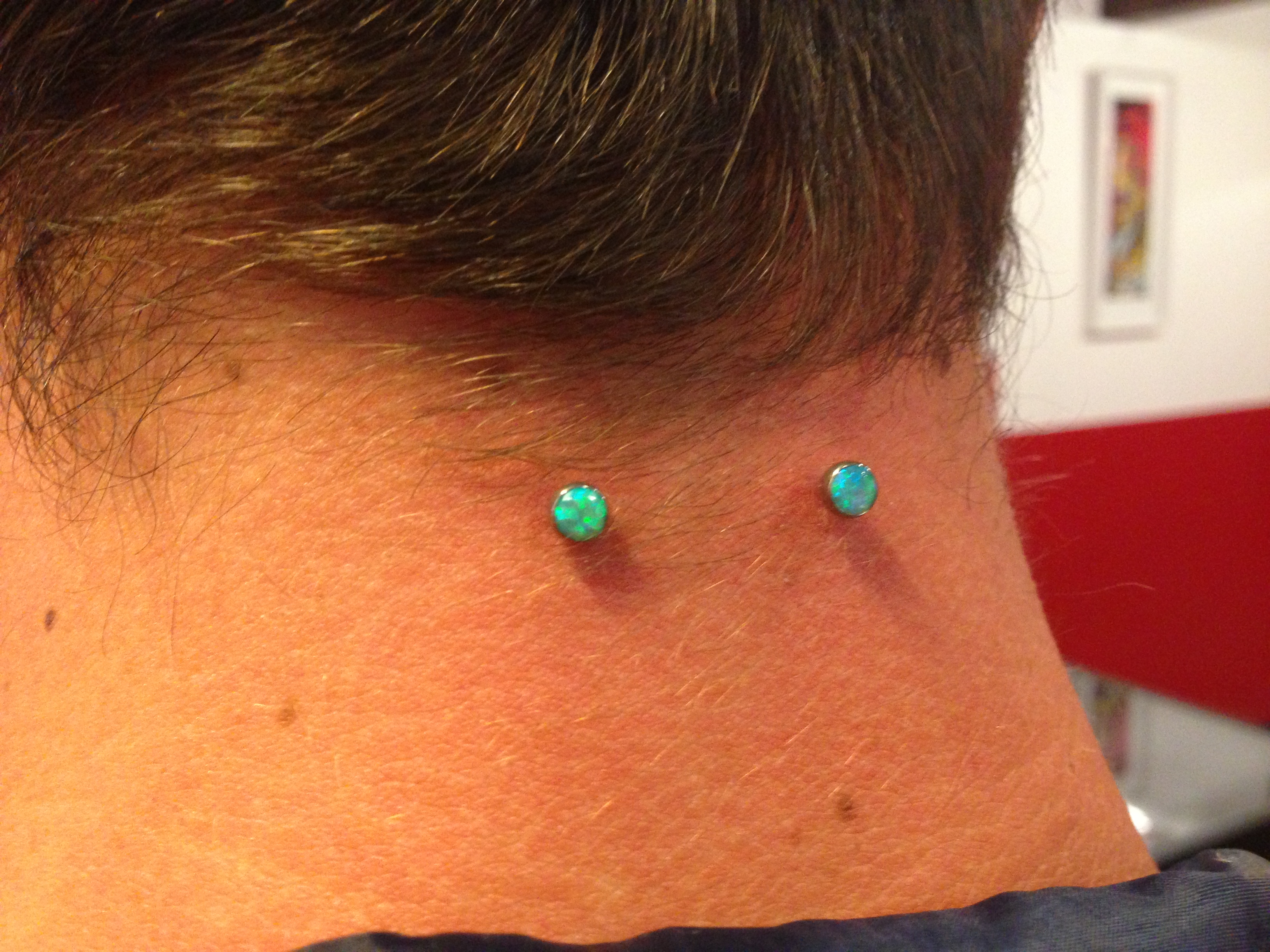 nape