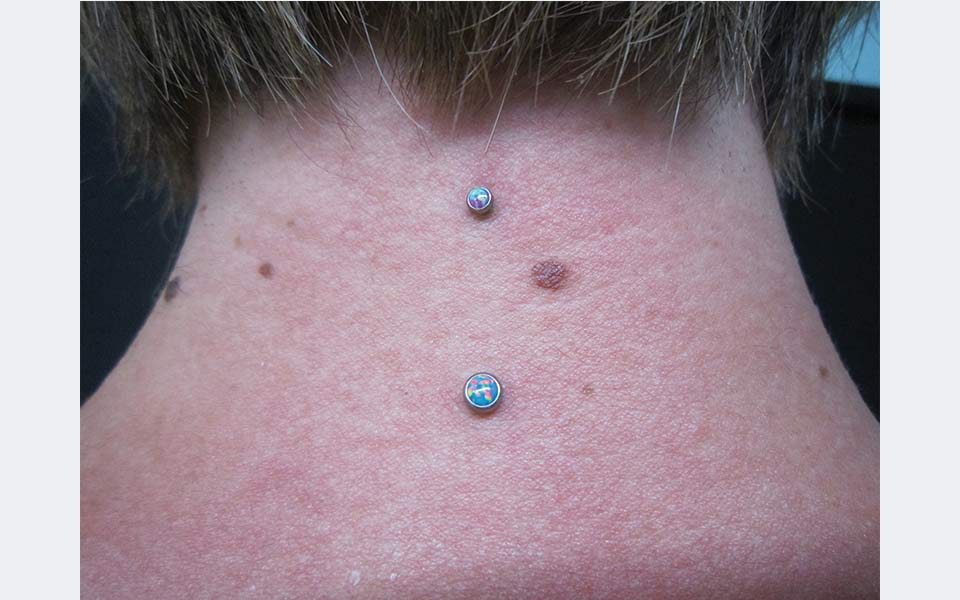 Microdermal Klinik