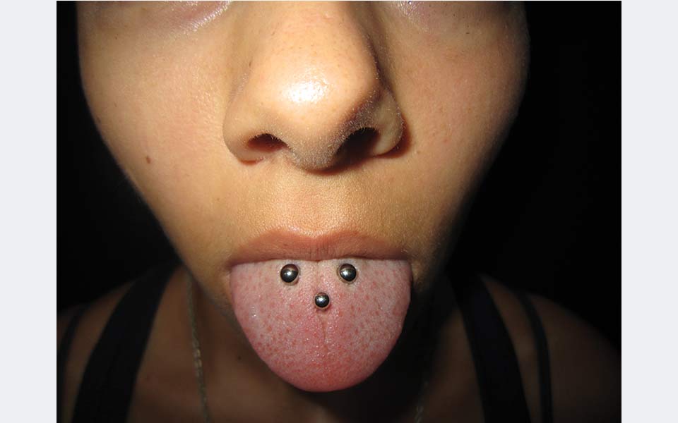 Piercing Klinik Lingua