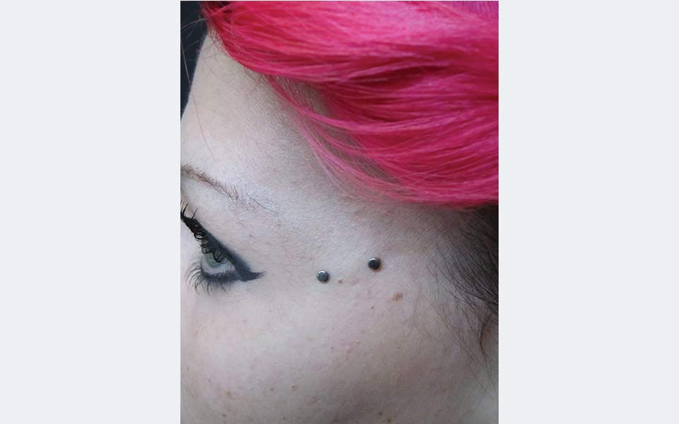 Microdermal Klinik Tizio