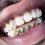 new new new!!!!! tooth gems per tutti